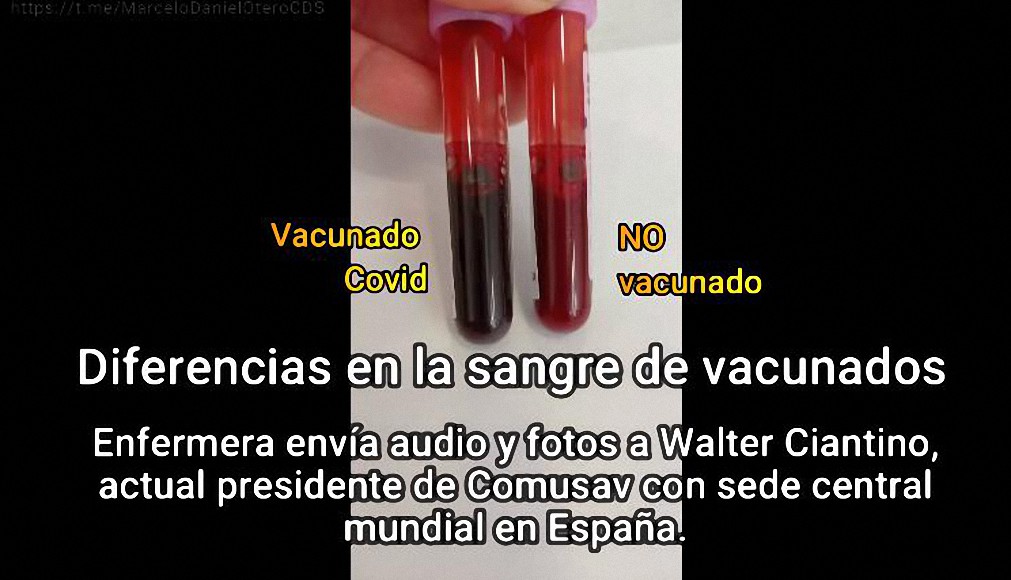 La sangre de los no vacunados vs La de los vacunados