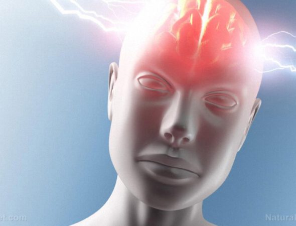 Lightning-Head-Brain-Headache