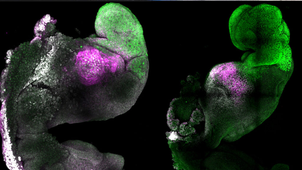 Crean el primer embrión ‘sintético’ con cerebro y corazón que late