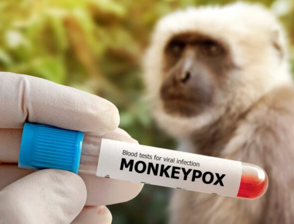 Medical,Worker,Holds,A,Test,Tube,With,Monkeypox,Virus,Infected