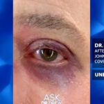 YouTube suspende al Dr. Drew después de mostrar una lesión ocular inducida por una vacuna