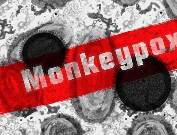 Monkeypox-750x375