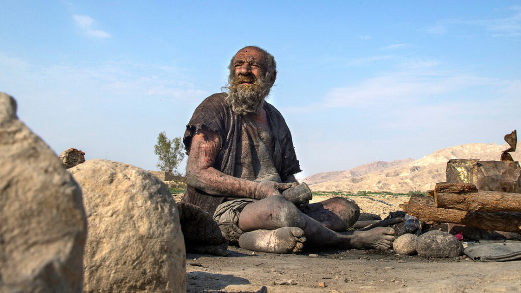 Muere a los 94 años el ‘hombre más sucio del mundo’ después de bañarse por primera vez en décadas