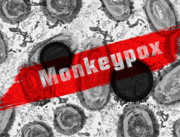 monkey-pox-7217582_960_720