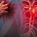 Australia ve un aumento de los ataques cardíacos en un 17% en 2022: los «expertos» culpan a la pandemia