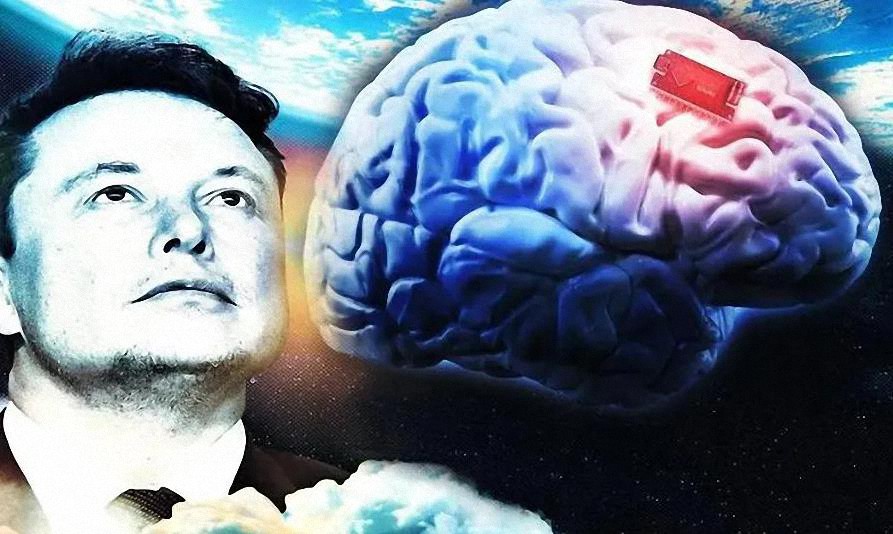 Neuralink de Elon Musk obtiene luz verde para reclutar humanos para pruebas de chips cerebrales